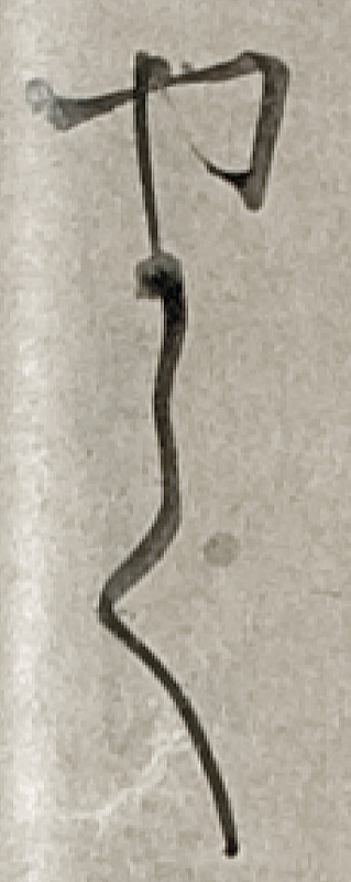 170128_hasimoto05yakate